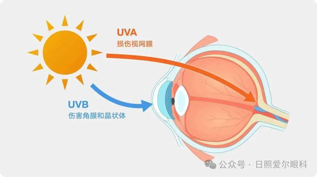 日照爱尔眼科小课堂丨经常晒太阳，会得白内障吗？